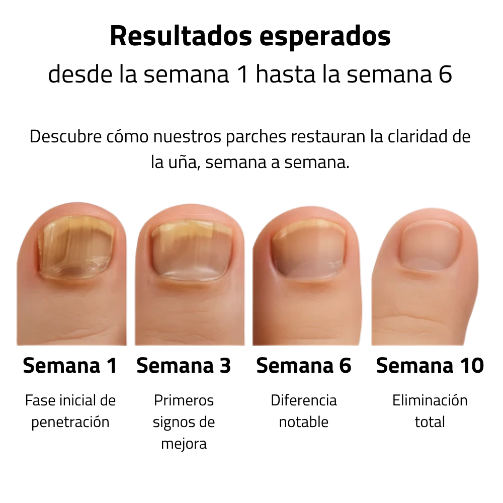 Curevia™ Parches Antihongos Reparadores